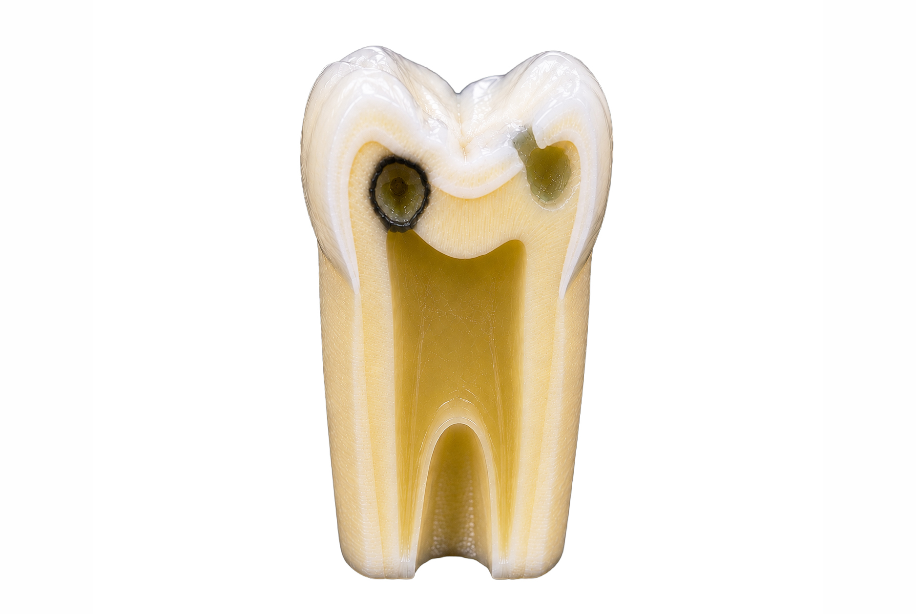 tooth-section-view-3