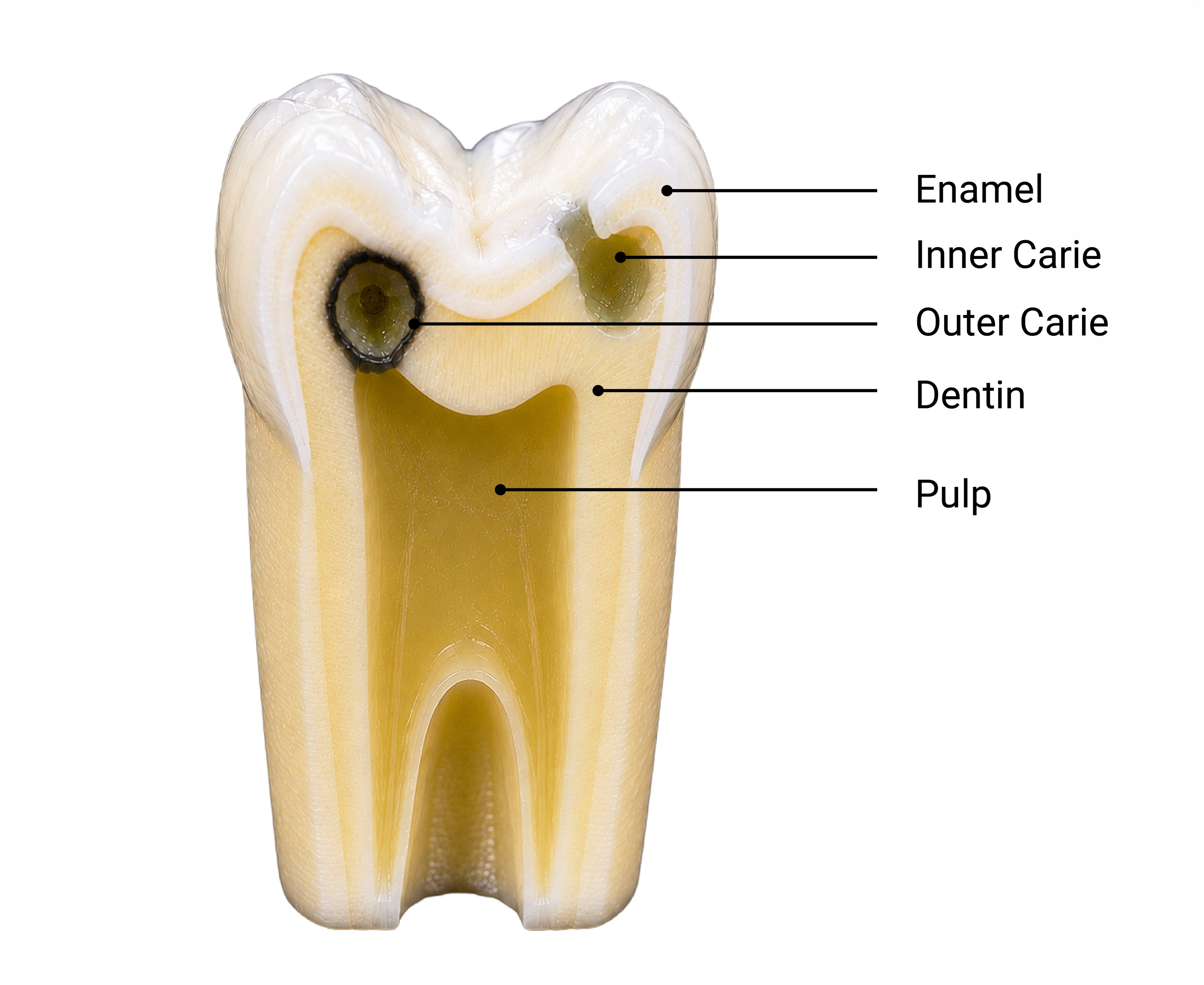 tooth-section-view-with-name